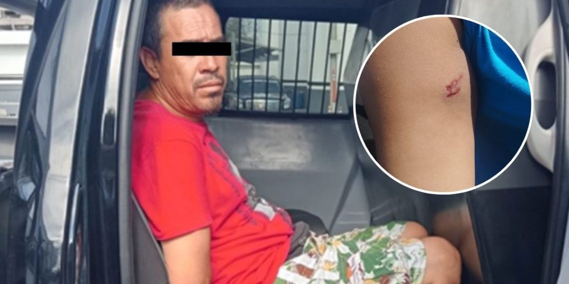 Hombre Detenido Por Lesiones A Empleada En Monterrey